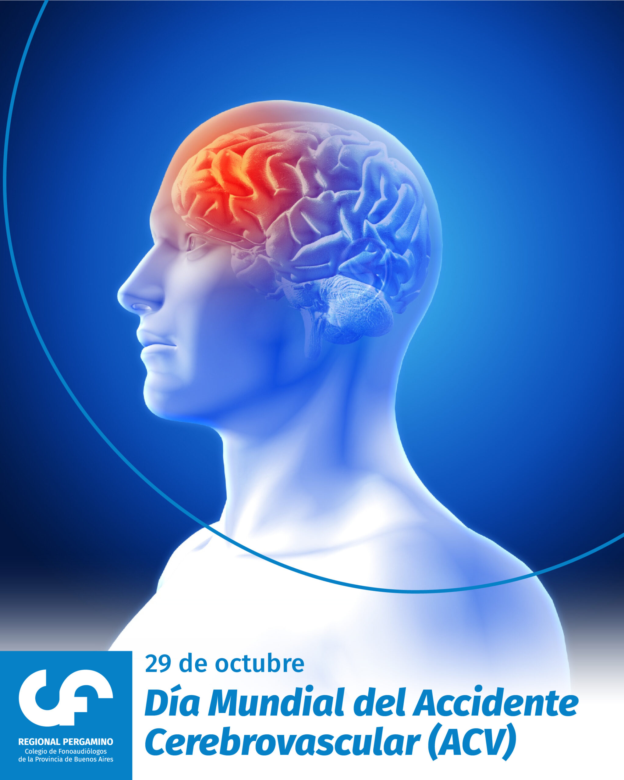 Día Mundial del Accidente Cerebrovascular (ACV)